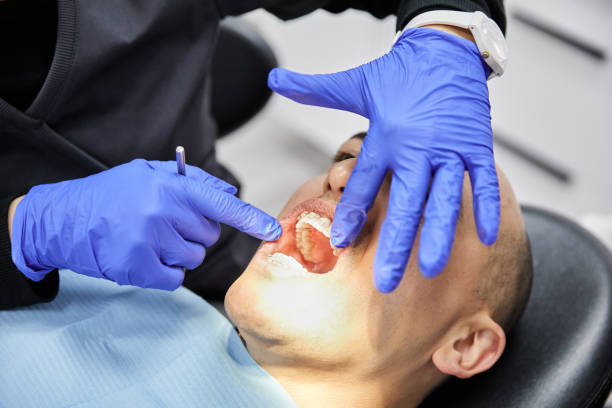 Best Emergency Tooth Extraction in Shoreline, WA