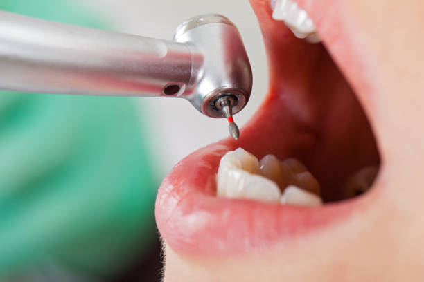 Best Emergency Denture Repair in Shoreline, WA